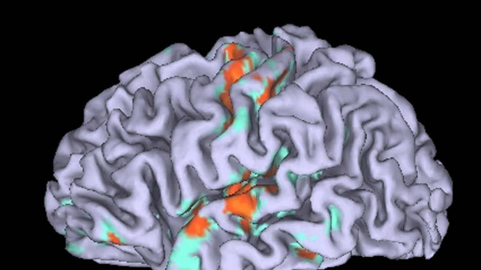 Ricostruita nel cervello l'origine della paura immotivata