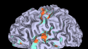 Scoperto un circuito del cervello che libera la creatività