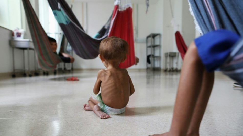 In Brazil's Amazon, malnourished Yanomami children get needed care